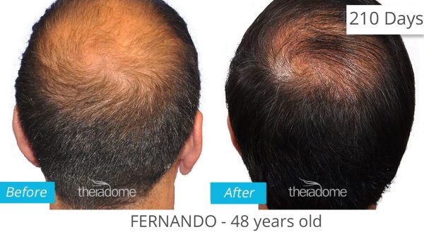 Advanced Hair & Scalp Fitness Program - Image 2