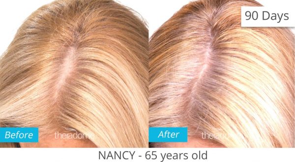 Advanced Hair & Scalp Fitness Program - Image 3