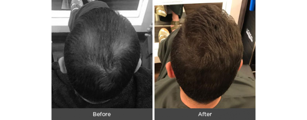 Hair Thickening Fibres - Image 4