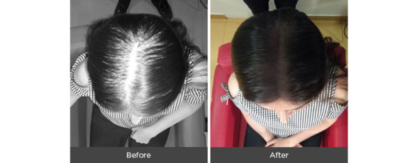 Hair Thickening Fibres - Image 3
